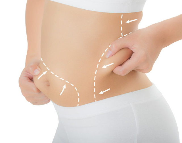 otyłość miejscowa, klinika medycyny estetycznej roseti med&beuaty w myślenicach