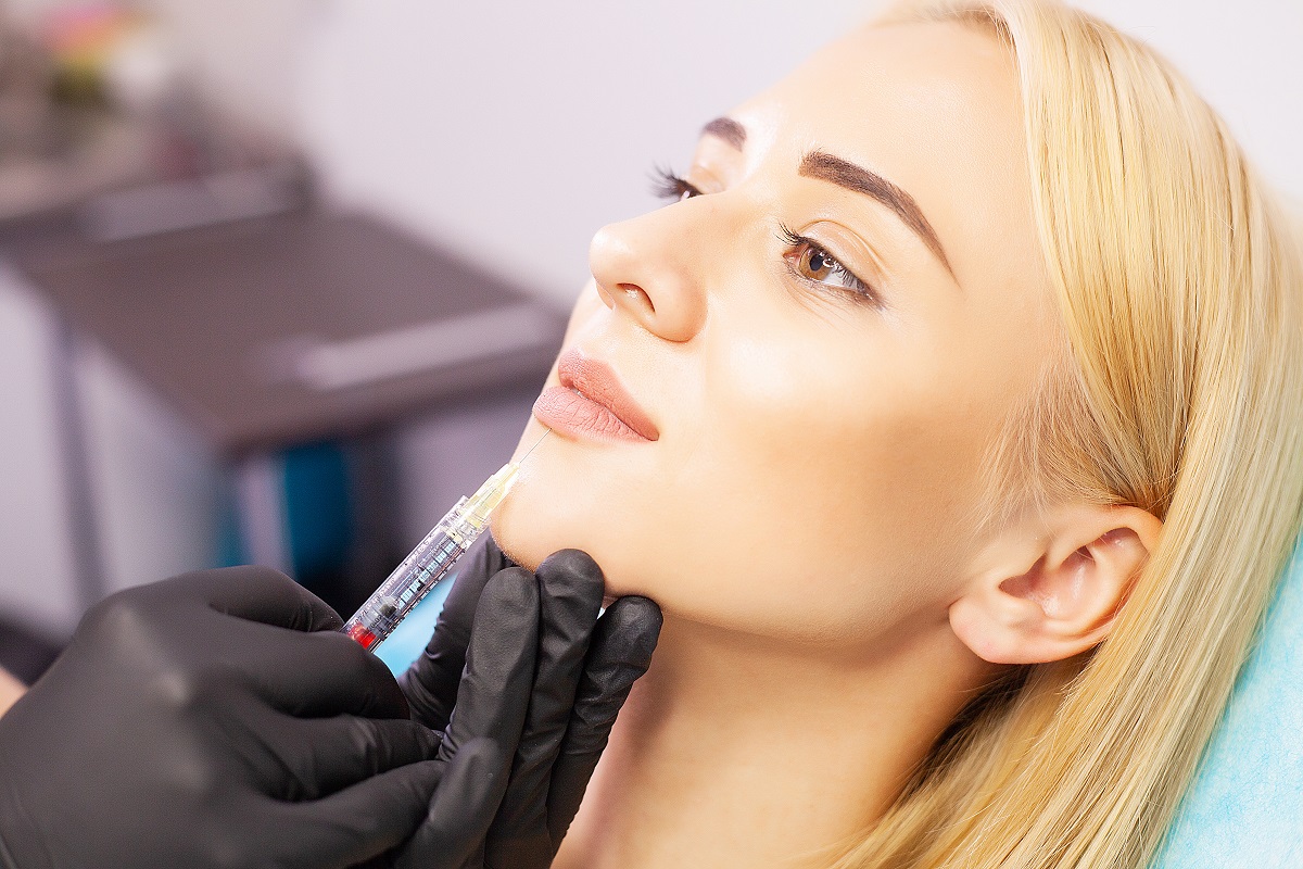 zabieg modelowania ust fibryną - efekty, klinika medycyny estetycznej roseti med&beauty w myślenicach