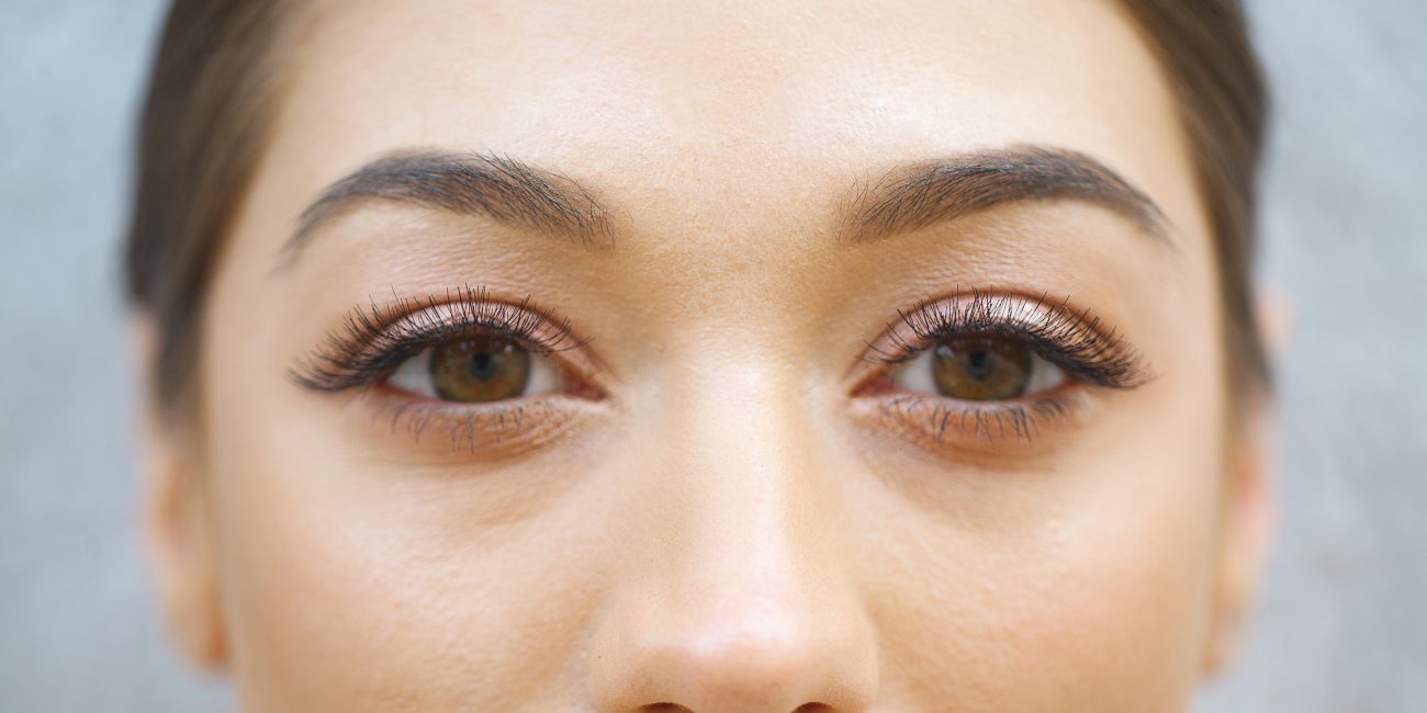 terapia powiek dolnych w klinice medycyny estetycznej roseti med & beauty w Myślenicach